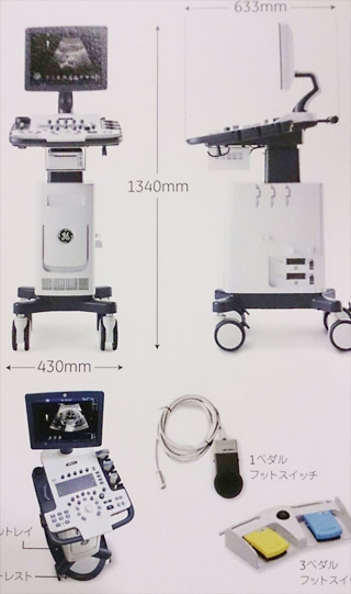 甲状腺エコー下穿刺細胞診